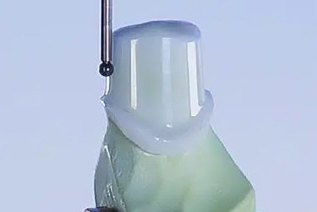 Renishaw-Taster beim Scannen eines Implantat-Abutments